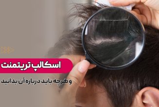 اسکالپ تریتمنت